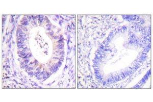 Immunohistochemistry (IHC) image for anti-Ribosomal Protein S6 Kinase, 90kDa, Polypeptide 3 (RPS6KA3) (Thr573) antibody (ABIN1847962) (RPS6KA3 antibody  (Thr573))