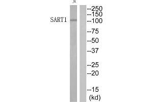 Western Blotting (WB) image for anti-Squamous Cell Carcinoma Antigen Recognized By T Cells (SART1) (Internal Region) antibody (ABIN1852322) (SART1 antibody  (Internal Region))