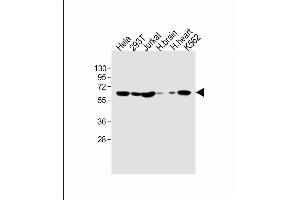 All lanes : Anti-IFNAR1 Antibody (Center) at 1:1000 dilution Lane 1: Hela whole cell lysate Lane 2: 293T whole cell lysate Lane 3: Jurkat whole cell lysate Lane 4: human brain lysate Lane 5: human heart lysate Lane 6: K562 whole cell lysate Lysates/proteins at 20 μg per lane.