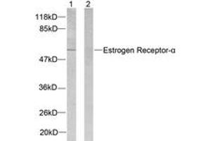 Western Blotting (WB) image for anti-Estrogen Receptor 1 (ESR1) (AA 81-130) antibody (ABIN2888985) (Estrogen Receptor alpha antibody  (AA 81-130))