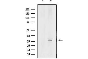 anti-Chromosome 14 Open Reading Frame 166 (C14orf166) antibody
