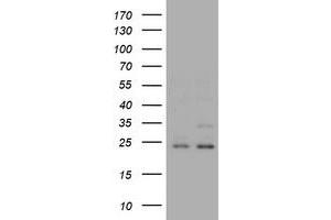 Image no. 2 for anti-RAB21, Member RAS Oncogene Family (RAB21) antibody (ABIN1500546)