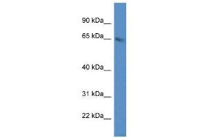 WB Suggested Anti-METTL3 AntibodyTitration: 1. (METTL3 antibody  (C-Term))