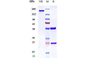 Anti-SCFR / c-Kit / CD117 Reference Antibody (LOP628) on SDS-PAGE under reducing (R) condition.