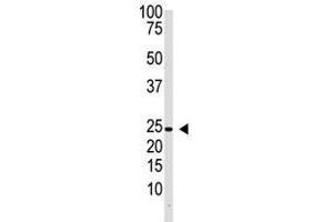 Image no. 1 for anti-Interleukin 29 (IL29) (Center) antibody (ABIN357175) (IL29 antibody  (Center))
