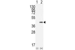 Western blot analysis of CDX2 antibody and 293 cell lysate (2 ug/lane) either nontransfected (Lane 1) or transiently transfected with the human gene (2). (CDX2 antibody  (AA 1-30))