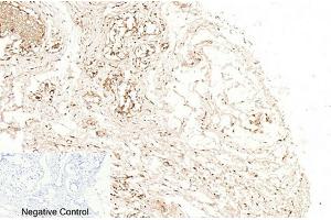 Immunohistochemical analysis of paraffin-embedded human breast tissue. (Caspase 1 antibody  (Cleaved-Asp210))