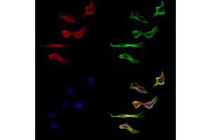 ABIN6262736 and ABIN6277134 staining Hela cells by IF/ICC. (KBTBD3 antibody  (C-Term))