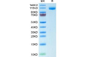 CD22 Protein (AA 20-687) (His tag)