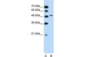 Western Blotting (WB) image for anti-Solute Carrier Family 10 (Sodium/bile Acid Cotransporter Family), Member 5 (SLC10A5) antibody (ABIN2462731) (SLC10A5 antibody)