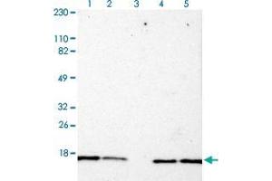 Western blot analysis of Lane 1: Human cell line RT-4 Lane 2: Human cell line U-251MG sp Lane 3: Human plasma (IgG/HSA depleted) Lane 4: Human liver tissue Lane 5: Human tonsil tissue with RPLP1 polyclonal antibody  at 1:100-1:250 dilution. (RPLP1 antibody)