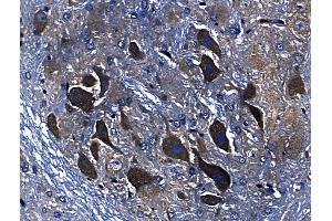 ABIN6259940 and ABIN6268705 at 1/100 staining Rat brain tissue by IHC-P. (Annexin A3 antibody  (N-Term))