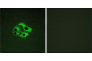 Immunofluorescence analysis of HeLa cells, using BAD (Phospho-Ser134) Antibody. (BAD antibody  (pSer134))