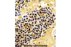 Immunohistochemistry (IHC) image for anti-Killer Cell Lectin-Like Receptor Subfamily C, Member 1 (KLRC1) antibody (ABIN2936813) (KLRC1 antibody)