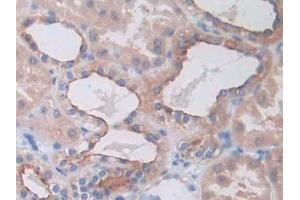SLC12A3 antibody  (AA 3-146)