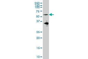 EYA2 monoclonal antibody (M04), clone 2F8 Western Blot analysis of EYA2 expression in IMR-32 . (EYA2 antibody  (AA 164-271))