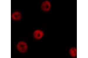 ABIN6266456 staining HuvEc by IF/ICC. (HNRNPD/AUF1 antibody  (pSer83))