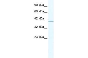 WB Suggested Anti-TRIM68 Antibody Titration:  2. (TRIM68 antibody  (C-Term))