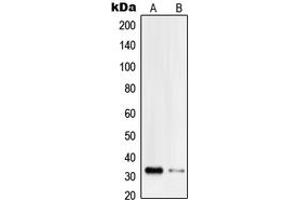 Western blot analysis of PI-TP beta expression in Jurkat (A), HeLa (B) whole cell lysates.