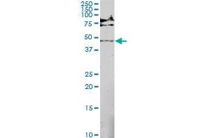 MAP2K5 monoclonal antibody (M01), clone M1-E6. (MAP2K5 antibody  (AA 1-448))
