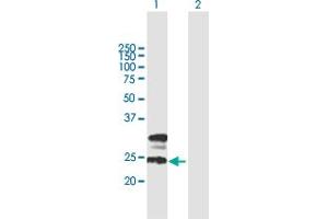 Western Blot analysis of TMEM27 expression in transfected 293T cell line by TMEM27 MaxPab polyclonal antibody. (TMEM27 antibody  (AA 1-222))