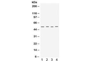 Western blot testing of 1) mouse testis, 2) mouse skeletal muscle, 3) human MCF7 and 4) human A549 lysate with Keratocan antibody.