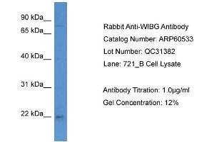WB Suggested Anti-WIBG  Antibody Titration: 0. (PYM antibody  (C-Term))