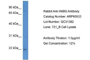 WB Suggested Anti-WIBG  Antibody Titration: 0.