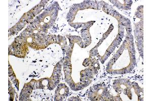 IHC analysis of TIMP4 using anti- TIMP4 antibody . (TIMP4 antibody  (AA 174-224))