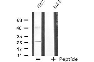 Western blot analysis of extracts from K562 cells, using CDC42EP3 antibody. (CDC42EP3 antibody  (Internal Region))