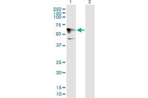 Western Blot analysis of HOMEZ expression in transfected 293T cell line by HOMEZ MaxPab polyclonal antibody. (HOMEZ antibody  (AA 1-526))
