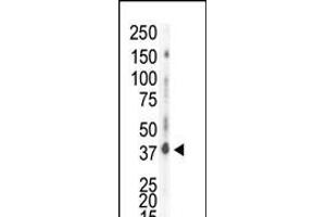 Western blot analysis of anti-CK1d C-term Pab (ABIN391599 and ABIN2841525) in HeLa cell lysate. (Casein Kinase 1 delta antibody  (C-Term))