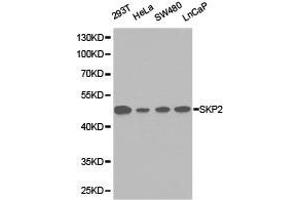 Western Blotting (WB) image for anti-S-Phase Kinase-Associated Protein 2 (SKP2) antibody (ABIN1874793) (SKP2 antibody)