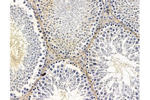 ABIN7095860 and ABIN7099922 at 1/100 staining rat testis tissue by IHC-P.