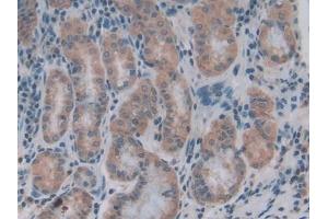 COL4A1 antibody  (AA 1444-1669)