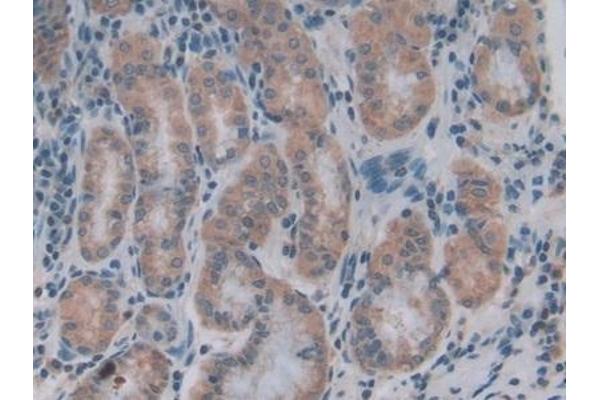 COL4A1 antibody  (AA 1444-1669)
