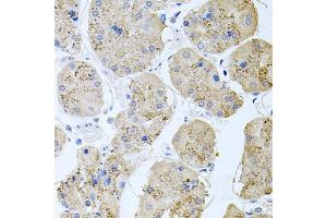 Immunohistochemistry of paraffin-embedded human stomach using RAPSN antibody (ABIN6132583, ABIN6146690, ABIN6146691 and ABIN6222434) at dilution of 1:100 (40x lens). (RAPSN antibody  (AA 1-353))