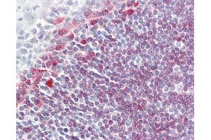 Anti-CD79A antibody IHC of human tonsil. (CD79a antibody  (Cytoplasmic Domain))