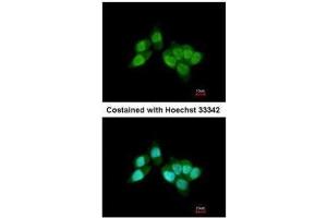 ICC/IF Image Immunofluorescence analysis of paraformaldehyde-fixed A431, using RCC1, antibody at 1:200 dilution.