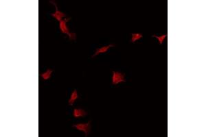 ABIN6275059 staining Hela by IF/ICC. (DKK3 antibody  (C-Term))