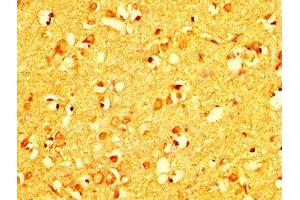 IHC image of ABIN7167266 diluted at 1:200 and staining in paraffin-embedded human brain tissue performed on a Leica BondTM system. (RAB26 antibody  (AA 1-58))