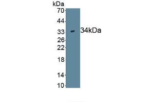 Detection of Recombinant WNT7B, Human using Monoclonal Antibody to Wingless Type MMTV Integration Site Family, Member 7B (WNT7B) (WNT7B antibody  (AA 216-349))
