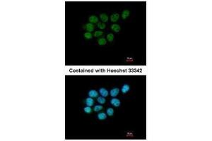 ICC/IF Image Immunofluorescence analysis of paraformaldehyde-fixed A431, using ARIH2, antibody at 1:200 dilution. (ARIH2 antibody  (C-Term))