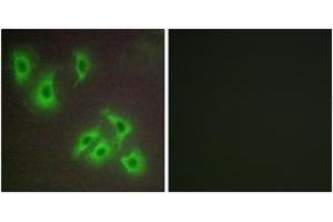Immunofluorescence analysis of HepG2 cells, using BCLW Antibody. (BCL2L2 antibody  (AA 131-180))