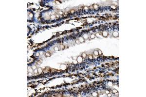 IHC analysis of USP16 using anti-USP16 antibody (ABIN7602640). (USP16 antibody  (AA 9-823))