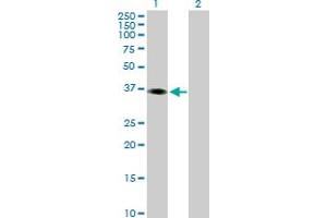Western Blot analysis of PHF15 expression in transfected 293T cell line by PHF15 MaxPab polyclonal antibody. (PHF15 antibody  (AA 1-246))