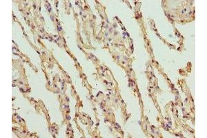 Immunohistochemistry of paraffin-embedded human lung tissue using ABIN7151751 at dilution of 1:100 (PROCR antibody  (AA 18-210))