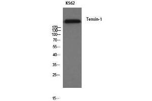 Western Blotting (WB) image for anti-Tensin 1 (TNS1) antibody (ABIN3180912) (Tensin 1 antibody)