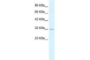 Human HepG2; WB Suggested Anti-PSMD14 Antibody Titration: 0.
