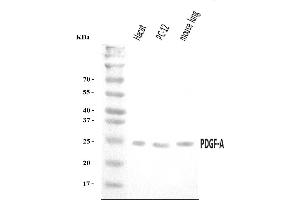 Western blot analysis of PDGF AA/PDGFA using anti-PDGF AA/PDGFA antibody (ABIN7602580).